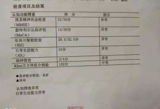 当一个科幻小说家患上“老年痴呆”：如何度过他的一天？