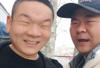 小眯眼哥陪小眯眼弟割双眼皮 结果哥哥先割上了