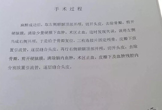 家属称男子三年前右脑出血被开左脑,医生发现出错又开右脑