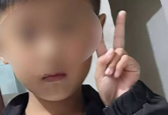 被爷爷误喂火锅燃料周口男童已清醒,孩子父亲:肾一直流血