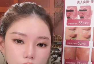 马筱梅患产前焦虑，孕晚期失眠浑身痛，坚持工作不靠别人，很独立