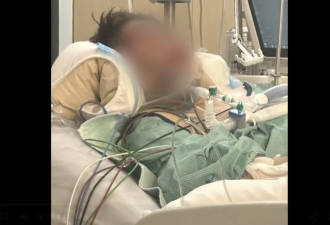 加拿大27岁男子戴耳机过马路, 被公交车撞残! 父亲表扬司机!