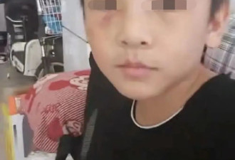14岁男孩疑遭生父继母虐待离世，官方回应