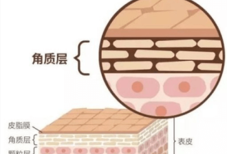 角质层过厚别硬搓 温和代谢+精准护理