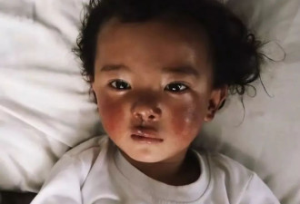 从李亚鹏事件看慈善：没有商业的公益,注定走不远