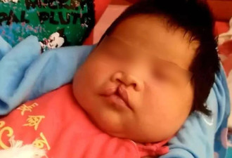 李亚鹏带货超七千万，依然难救嫣然医院