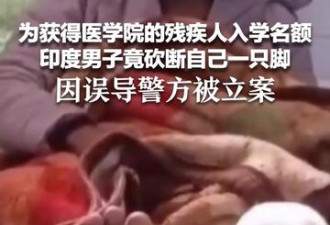 为获医学院残疾人入学名额 印度男子竟砍断自己脚