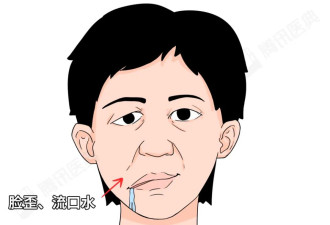“看脸”很重要！这6种面相是身体在报警