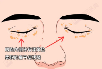 “看脸”很重要！这6种面相是身体在报警