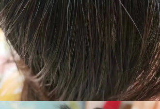 “逆转白发”产品五花八门 专家：不如好好吃饭睡觉
