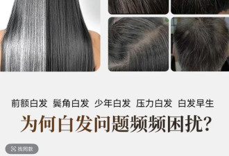 “逆转白发”产品五花八门 专家：不如好好吃饭睡觉