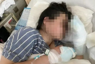 女大学生到东北游玩意外晕倒 雪地冻伤 面临截肢