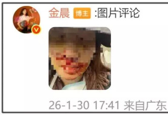 金晨被质疑下水军洗白，甩锅式公关翻车