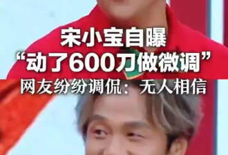 宋小宝自曝动600刀做微调！网友纷纷调侃：无人相信