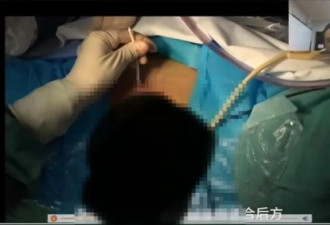 陕西医院手术直播无码暴露女患者，麻烦了