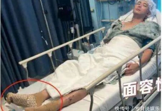 演员陈学冬两年内做4次手术，11部作品被下架，如今生活无法自理