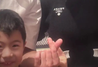 章子怡与师弟吃火锅，医美后遗症出来了...