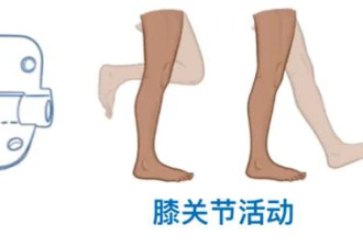 上楼与下楼，谁才是膝盖的“隐形杀手”？