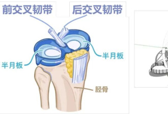 上楼与下楼，谁才是膝盖的“隐形杀手”？