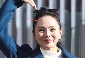 伊能静春晚彩排状态差，脸僵馒化医美明显