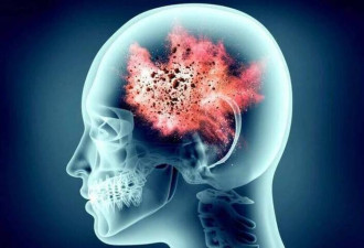 1/3人脑中有寄生虫？研究揭人体“自毁开关”