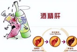 一天一苹果，脂肪肝绕着走？