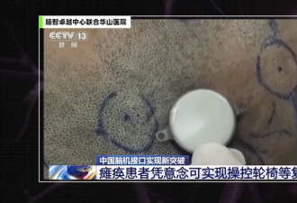 马斯克的脑机接口 为何一定要在头顶上开个洞？