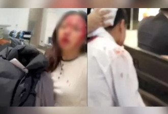 杜拜机场遭无人机攻击！亚裔女满脸血逃命画面曝光