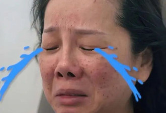 TVB知名演员到韩国整容，狠心打医美针血流满面，直接痛到落泪