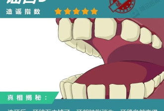 洗牙的8大传言，据说99%的中国人都信了