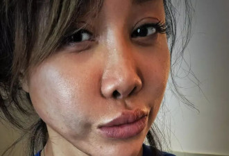 央美才女跨界打格斗,挨耳光险脑干出血,却说都是擦伤