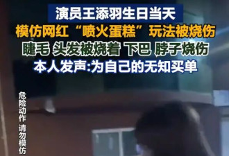 《美人鱼》女星回应模仿网红“喷火蛋糕”被烧伤！称自己被害惨了