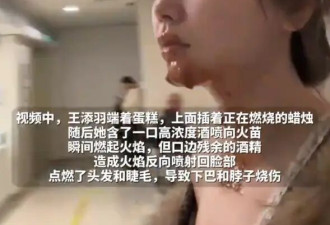 《美人鱼》女星回应模仿网红“喷火蛋糕”被烧伤！称自己被害惨了