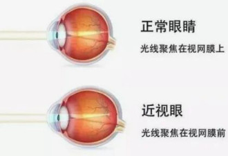网上热议的视力恢复训练，到底靠不靠谱？