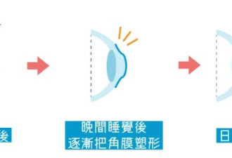 网上热议的视力恢复训练，到底靠不靠谱？