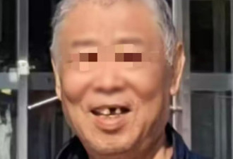 69岁老人拔牙即种4天后离世：两门牙松动拔了六颗牙