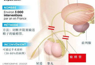 一年50万男人结扎，这个月特别多