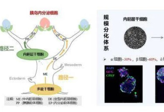 治疗糖尿病 我国科学家称找到新路径