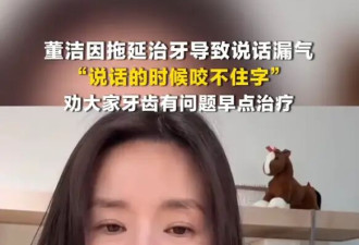 董洁因拖延治牙导致说话漏气！劝大家牙齿有问题早点治疗