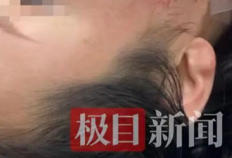 中国女游客在泰国中弹 子弹射穿右脸打掉多颗牙