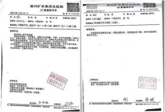 74页病历被修改30次 男子做骨折手术 神经损伤
