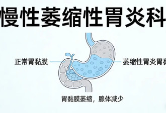 警惕！这5种炎症不重视 可能悄悄变成癌症