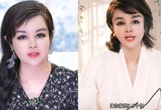 富豪于文红推广富人换年轻人血液“回春”海尔急切割