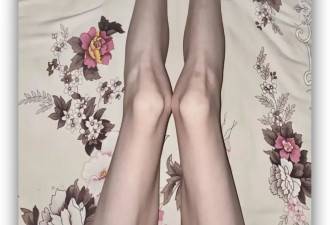 ED网红病，正在掏空年轻女性