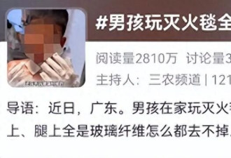 深圳一男孩玩灭火毯全身扎满“细针”! 妈妈崩溃