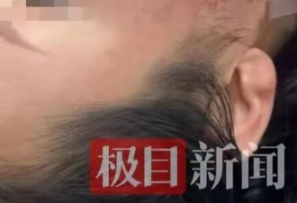 中国游客在泰国中弹，女儿：母亲住院只能吃流食