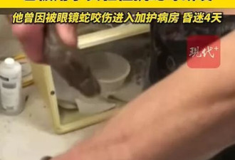 男子20年间被毒蛇咬200多次；现血液中已产生抗体