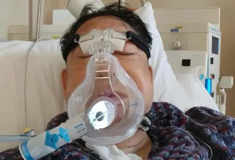 香港知名演员肾脏出问题，身材消瘦双颊凹陷，感激医生救命免破产