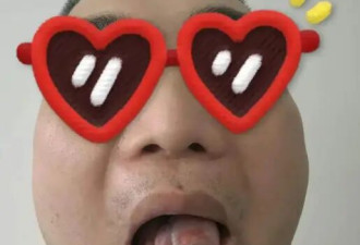 深圳41岁男子被切掉半条舌头，医生紧急提醒