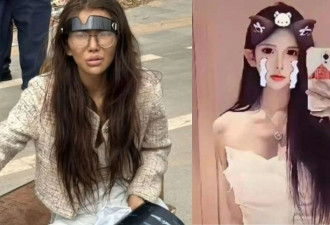 女网红断腿街头流浪 直播揭卖猪仔内幕突遭封禁